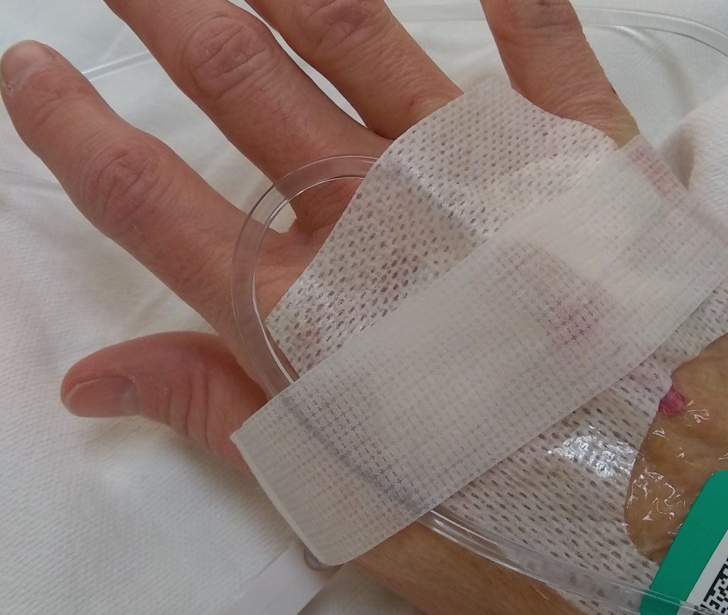 My hysterectomy experience, hysterectomy, pmdd, ovarian cysts, fibroids
